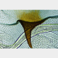 05 Blastobasis glandulella w signum