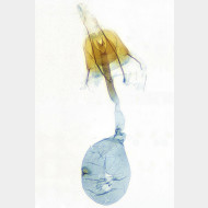 05 Coleophora flavipennella w