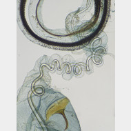 02 Coleophora ornatipennella w ductus