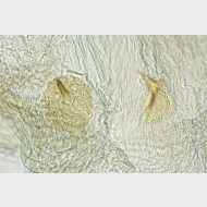 04 Limnaecia phragmitella w signum