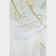 01 Elachista metella w ostium