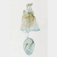 02 Amblyptilia acanthadactyla w