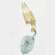 0000 Stenoptilia bipunctidactyla w v2