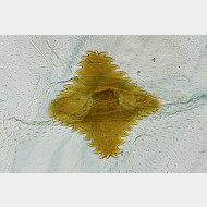 04 Carpatolechia proximella w signum