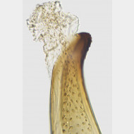 01 Teleiodes flavimaculella Mikrospines