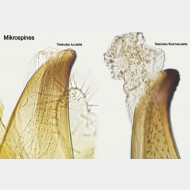 02 Teleiodes flavimaculella Mikrospines