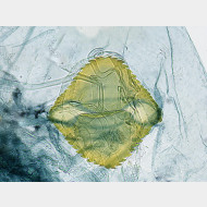 Teleiodes luculella w signum