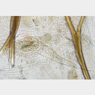 03 Glyphipterix bergstraesserella w ostium