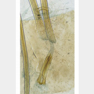 00 Glyphipterix simpliciella w ostium