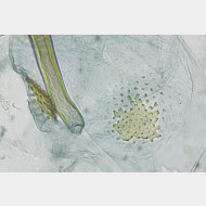 000 Glyphipterix simpliciella w signum