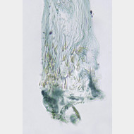 03 Macrosaccus robiniella w signum