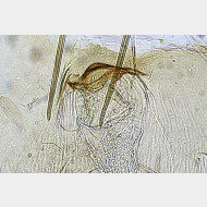 00 Parornix torquillella w ostium