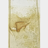 04 Parornix torquillella w ostium