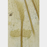 00 Phyllonorycter froelichiella w ostium