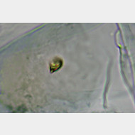 04 Phyllonorycter klemannella w Signum