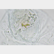 Phyllonorycter maestingella w signum3