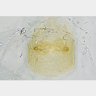 02 Phyllonorycter pastorella w signum