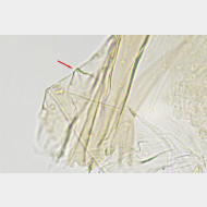 Phyllonorycter stettinensis m det