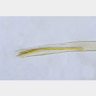 Argyresthia aurulentella m a sp