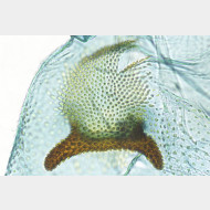 08 Argyresthia bergiella w signum