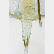 04 Argyresthia bonnetella w ostium