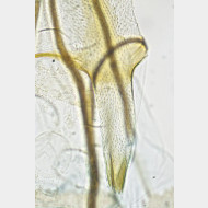 01 Argyresthia bonnetella w ostium