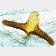 05 Argyresthia bonnetella w signum