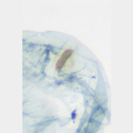 01 Argyresthia retinella w bursa