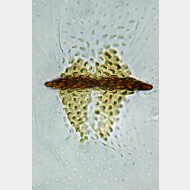 003 Argyresthia retinella w signum3