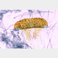 02 Argyresthia retinella w signum