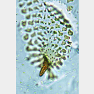 07 Lyonetia clerkella w signum