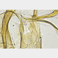 03 a Ectoedemia albifasciella m a