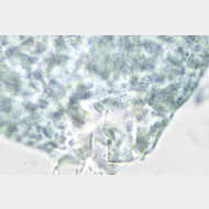 03 Stigmella carpinella w signum unten