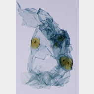 Tinea pellionella w bursa