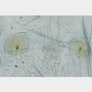 02 Tinea pellionella w signum
