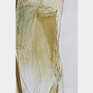 05 Tinea trinotella w antrum