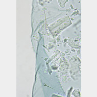 02 Tinea trinotella w spines