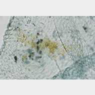 03 Spatalistis bifasciana w signum